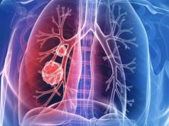 खळबळजनक :- कर्करोग कसा होतो यांचे निदान लागल्याने सर्वांचीच चिंता वाढली.